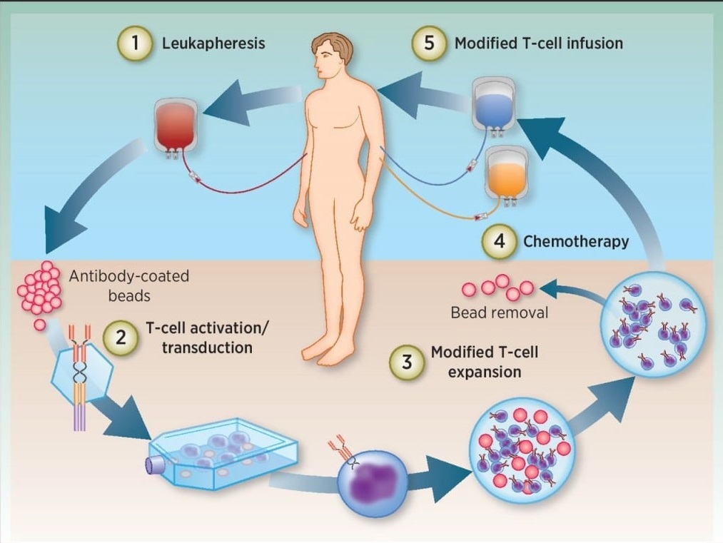 celulas car-t leucemia
